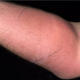 Illustration for article titled Man Injects 18 'Doses' of Semen Into Arm to Cure Back Pain, Ends Up in Hospital